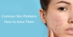 The Ultimate Guide to Skin Care Products in Pakistan: Finding the Best Moisturizer for Oily Skin, Whitening Cream, and Sunblock